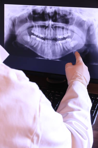 Best Emergency Wisdom Tooth Extraction in Appalachia, VA